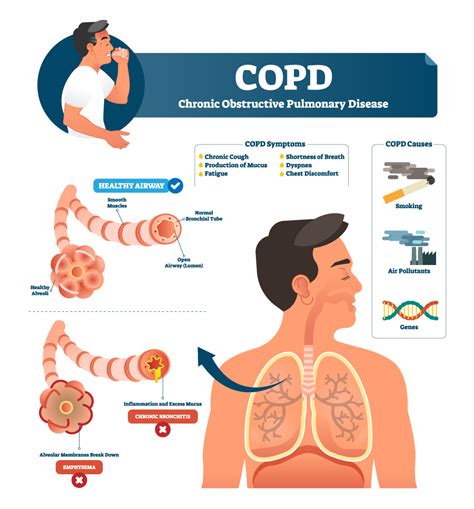 COPD